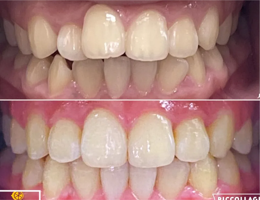 Lemoncreek Dental before and after patient photo